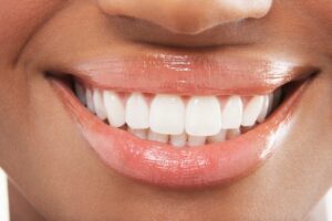 savannah periodontal disease