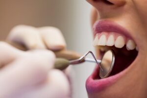 Learn why periodontal maintenance in Savannah, GA, is important for your health.